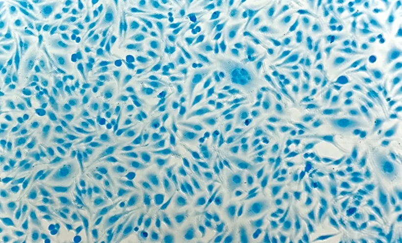 Image do post Idade Aumenta o Risco de Lesões Pré-Cancerígenas do Colo do Útero em Mulheres que Vivem com HIV, Aponta Revisão Internacional