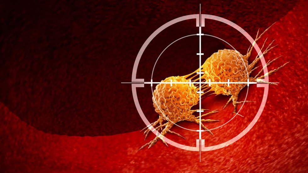 Image do post Inteligência Artificial e Imagens 3D Avançam na Detecção Precoce de Células do Cancro do Colo do Útero