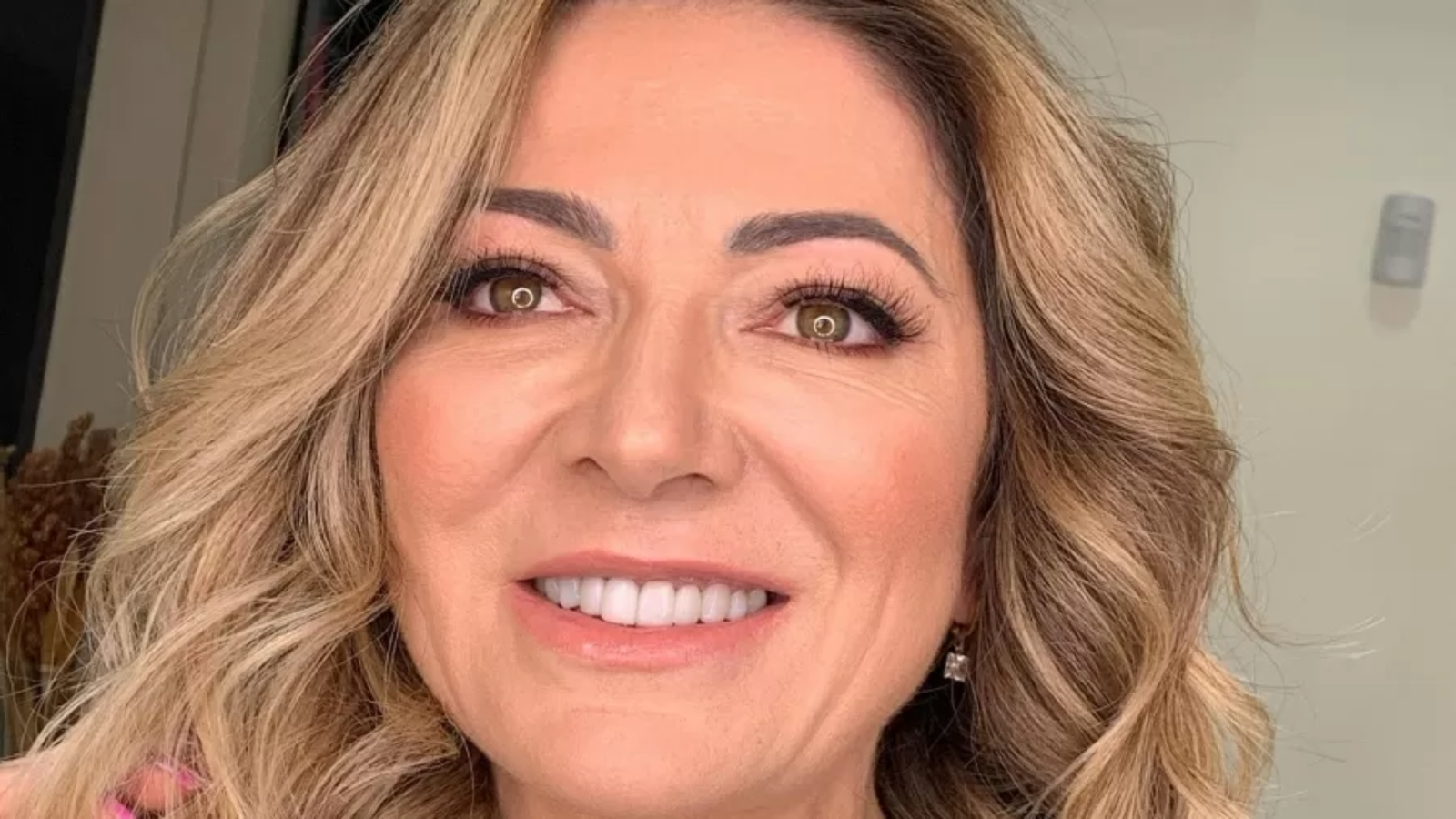 Image do post Alopecia areata: condição autoimune ganha atenção no Brasil após relato de familiar de Lucas Lucco